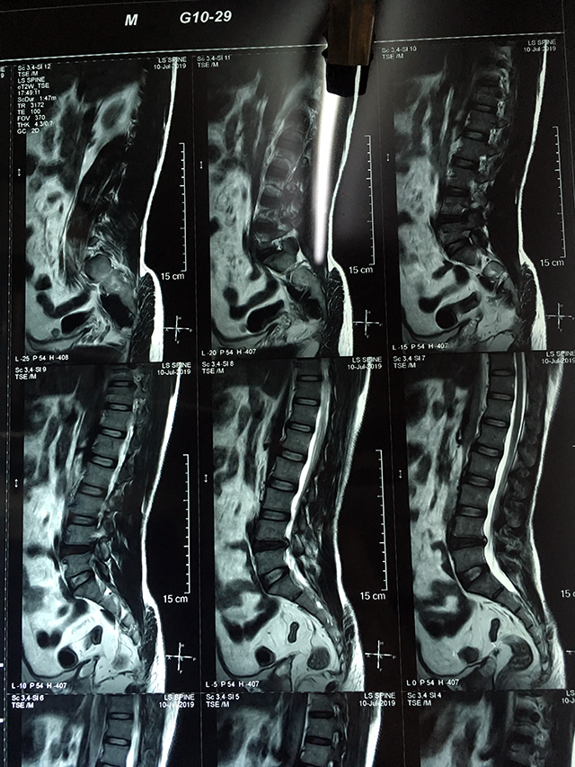 Pre-Op Image 2 - Shyamal